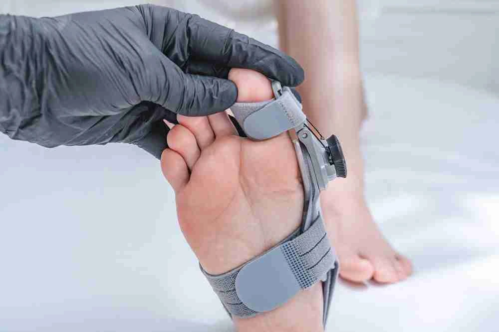 Gloved hand adjusting orthopedic toe brace for bunion correction at Lakeside Foot and Ankle
